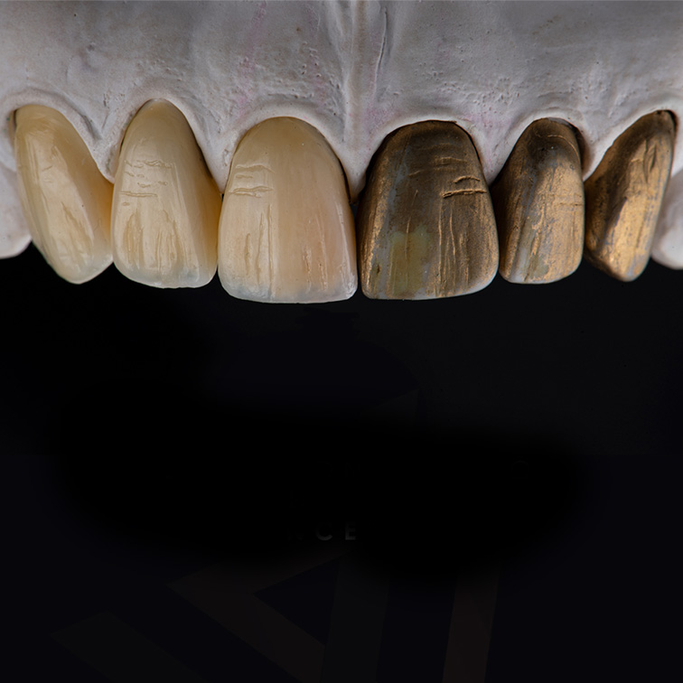 Copia de Encerado academy